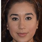 Ethnic Rhinoplasty Before & After Patient #8247