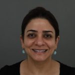 Regenelift™ Facelift Before & After Patient #9788