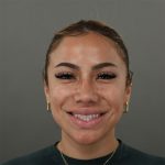 Rhinoplasty Before & After Patient #9990