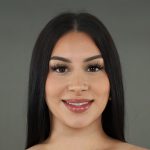 Rhinoplasty Before & After Patient #9999