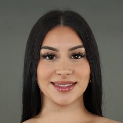 Rhinoplasty Before & After Patient #9999