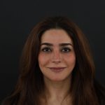 Regenelift™ Facelift Before & After Patient #9788