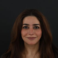 Regenelift™ Facelift Before & After Patient #9788