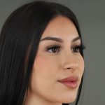 Rhinoplasty Before & After Patient #9999