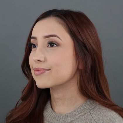 Rhinoplasty Before & After Patient #9791