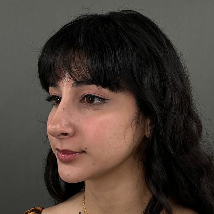 Rhinoplasty Before & After Patient #9986