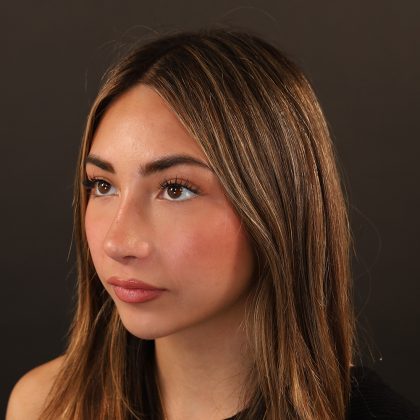 Rhinoplasty Before & After Patient #9987