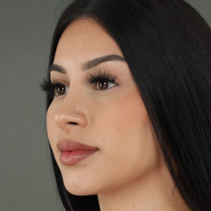 Rhinoplasty Before & After Patient #9999