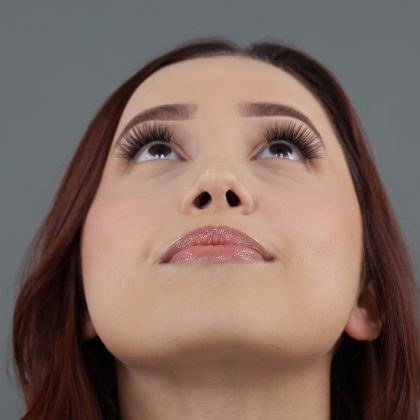 Rhinoplasty Before & After Patient #9791