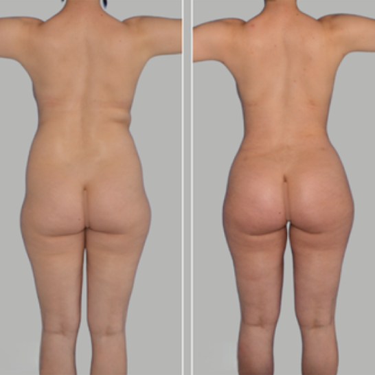 B&A