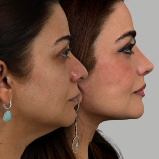 B&A